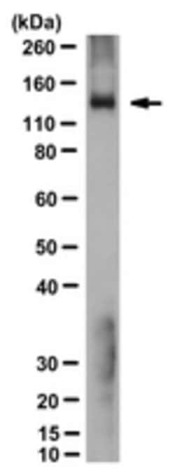 Chikungunya virus Mouse anti-Virus, Clone: 3E7b, MilliporeSigma:Antibodies:Primary
